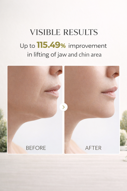 Zivetta V- Lifting Mewing Band