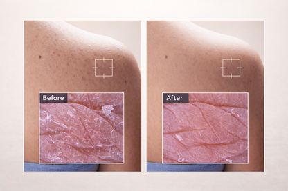 Zivetta Kojic Acid Turmeric Pads